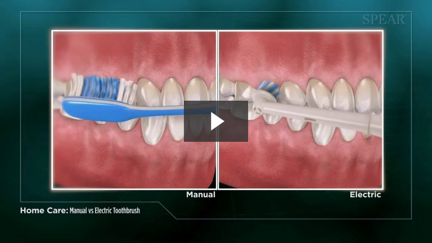 Manual versus Electric Toothbrush