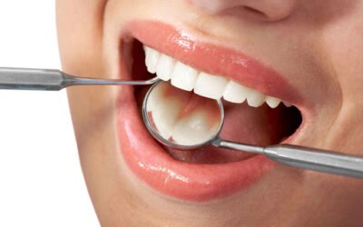 Dental Bridges & Implants – How are They Different?