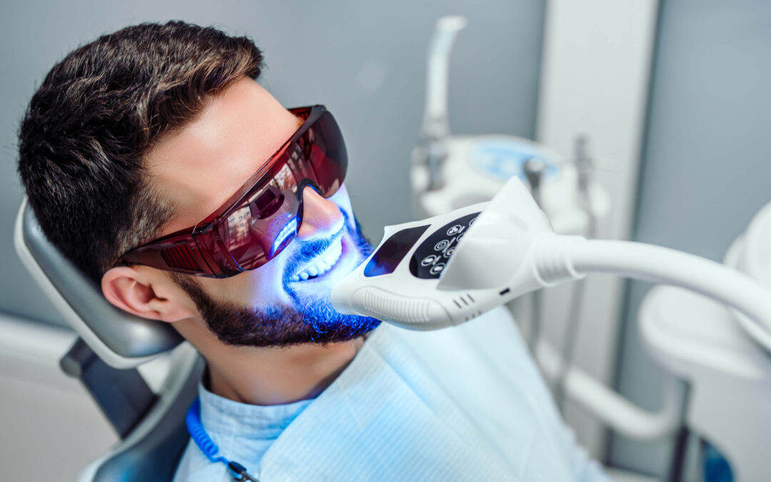 How Long Does Professional Teeth Whitening Last?
